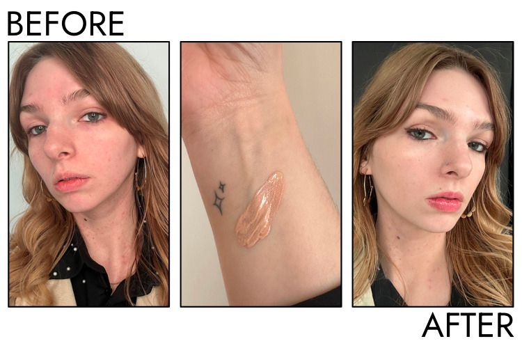 Before and after comparison of a person using a blurring and undetectable concealer.