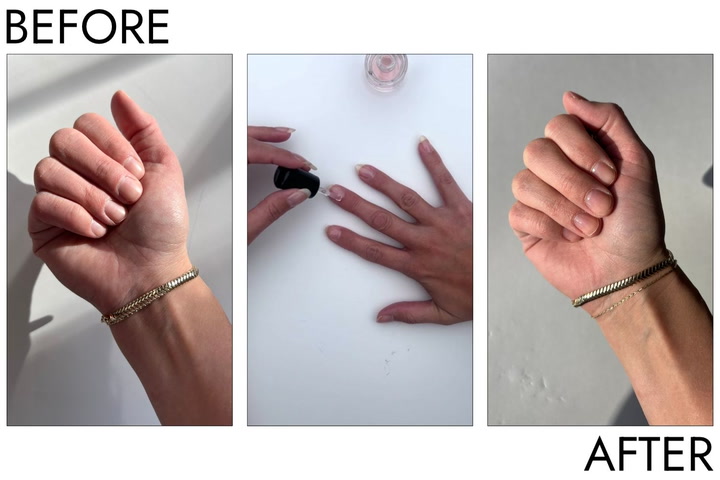 Before and after comparison of nail growth using Duri Rejuvacote serum.