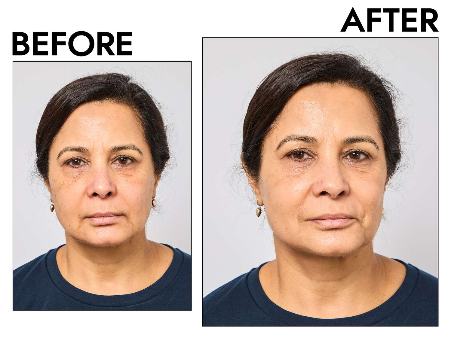 Before and after photo of a woman using Hourglass Veil Hydrating Skin Tint showing a dewy finish.