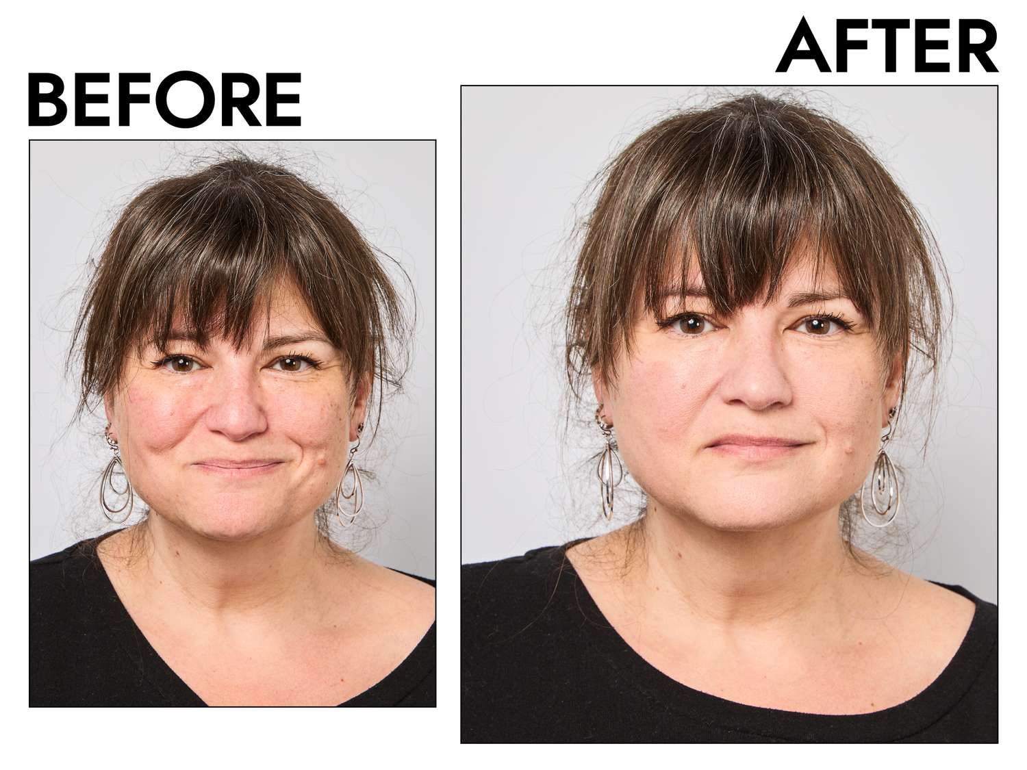 Close-up before and after photo showcasing the effects of a radiant skin tint with hyaluronic acid.